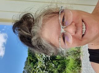 How I got rid of Pain in the roots of my scalp hair & Pressure on Top of my head👱♀️